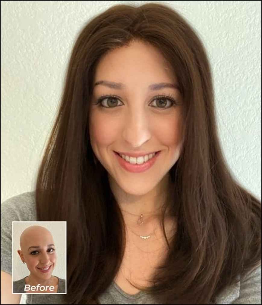 A woman wearing a short, textured blonde pixie-style wig, showcasing natural-looking medical wigs designed for style and comfort during hair loss.